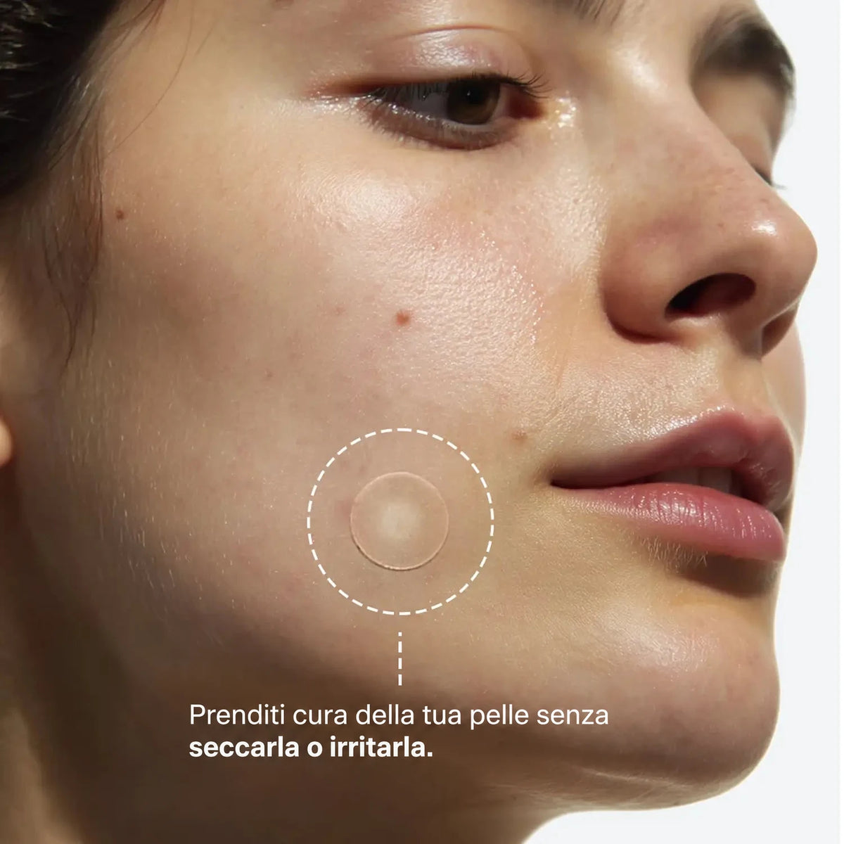 clear-dots-acne-patches gallery 3 (it)