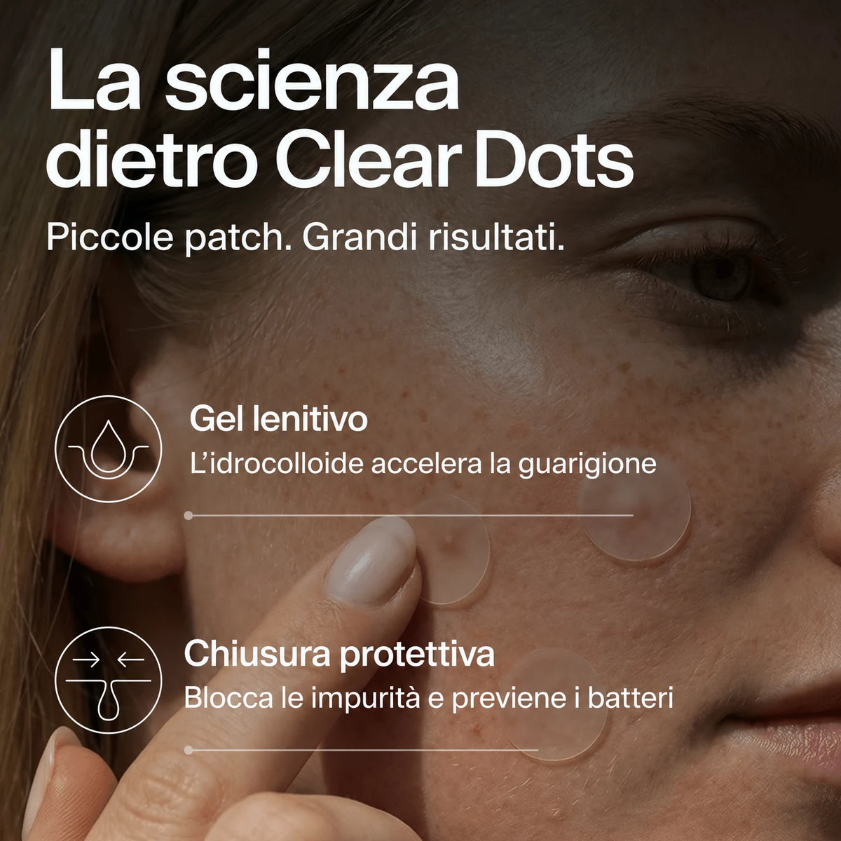 clear-dots-acne-patches gallery 5 (it)