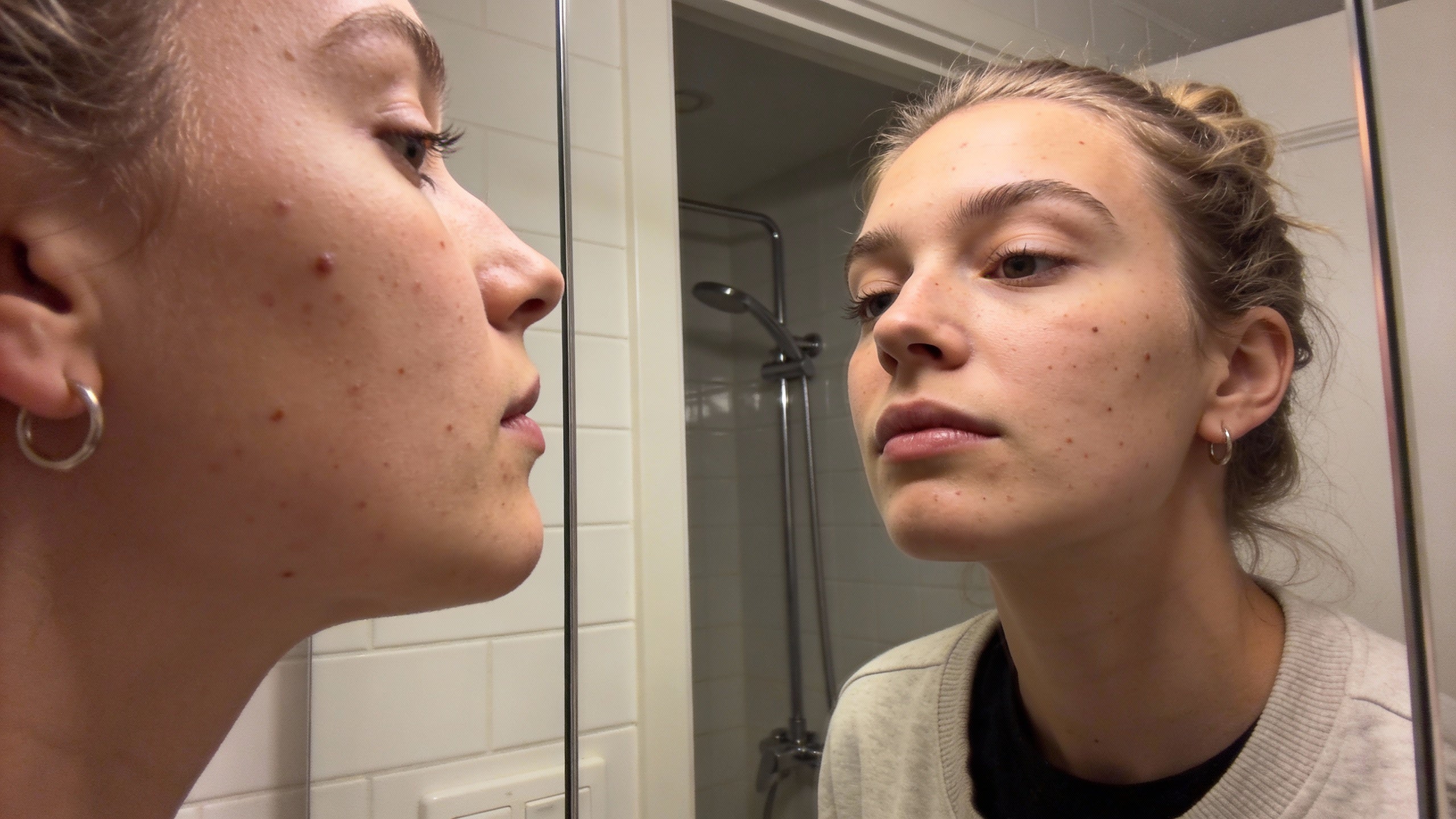 Vrouw bekijkt haar huid met zichtbare onzuiverheden in badkamerspiegel