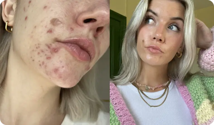 Anaïs — After 10 weeks
