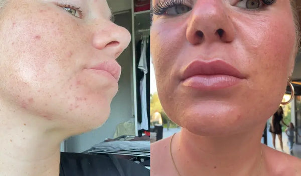 Il mio mento è finalmente tranquillo