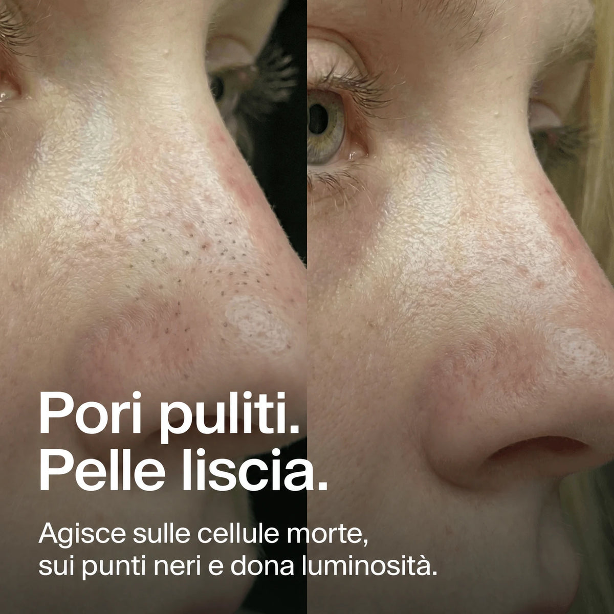 nose-patches gallery 5 (it)