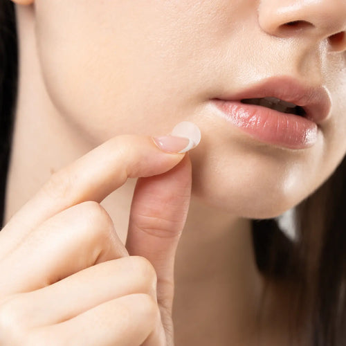 Clear Dots - Cerotti per l'acne