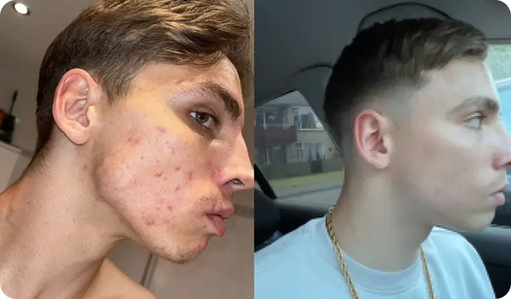 Damian — After 6 weeks