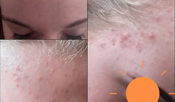 La sua pelle si è calmata, e anche lei.