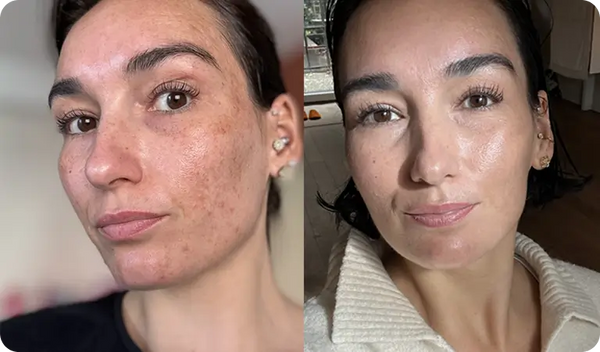 La mia pelle è più calma e uniforme