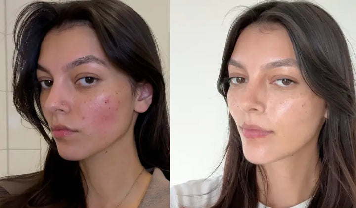 Gabrielle — After 9 weeks