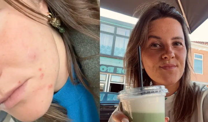 Gaby — After 12 weeks
