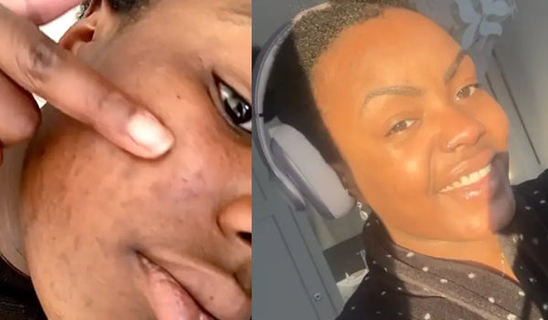 È iniziato con meno sebo