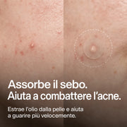 clear-dots-acne-patches gallery 2 (it)