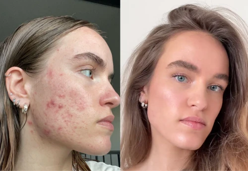 Before / After